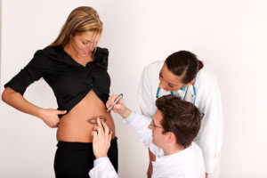 Ärzte markieren die Fettabsaugung bei einer Frau